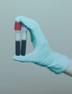 A gloved hand holds two vials of blood, carefully labeled and ready for lab testing. The vials contain deep red liquid, symbolizing a focus on wellness and health assessment. The background is softly blurred, emphasizing the precision and care involved in diagnostic testing.