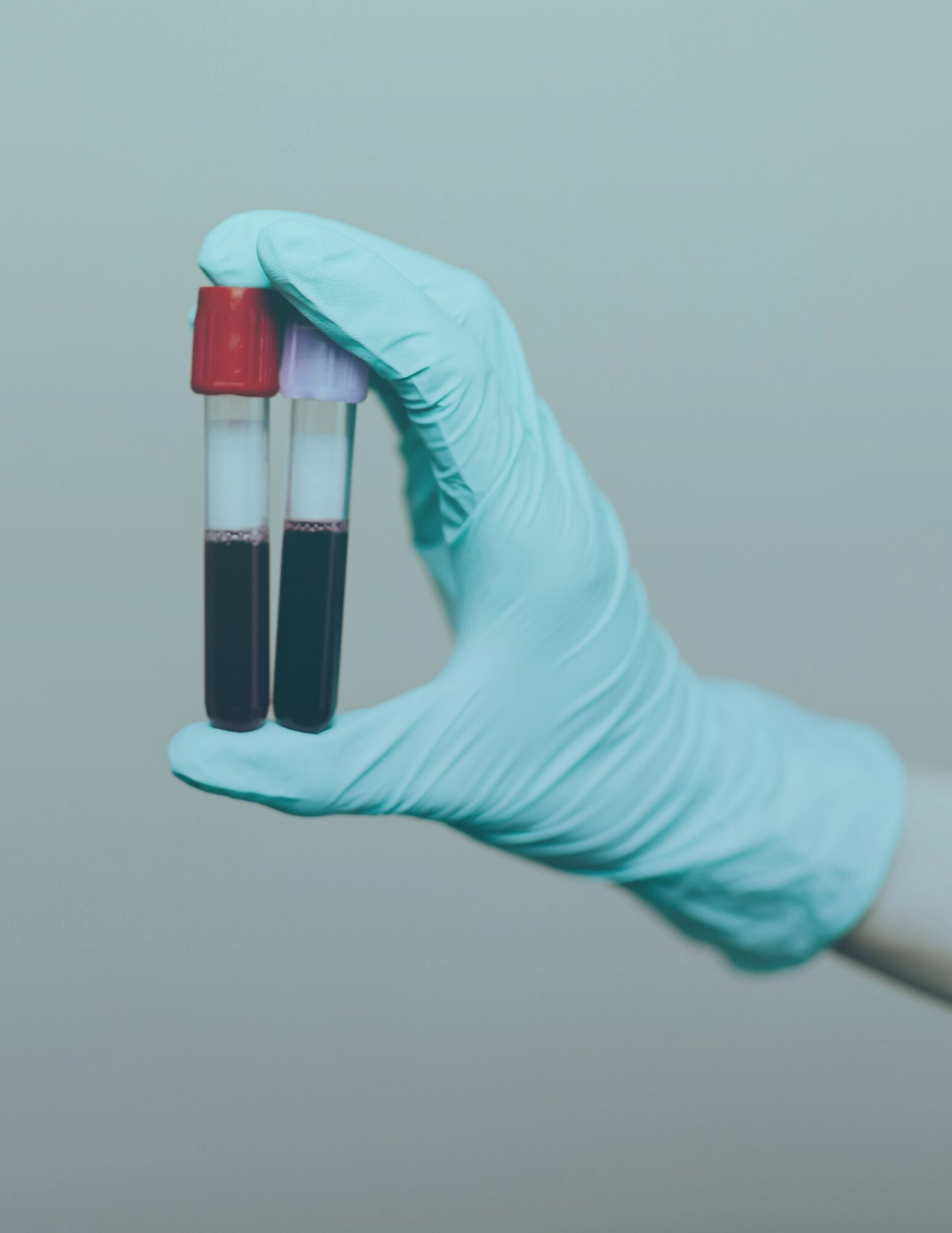 A gloved hand holds two vials of blood, carefully labeled and ready for lab testing. The vials contain deep red liquid, symbolizing a focus on wellness and health assessment. The background is softly blurred, emphasizing the precision and care involved in diagnostic testing.
